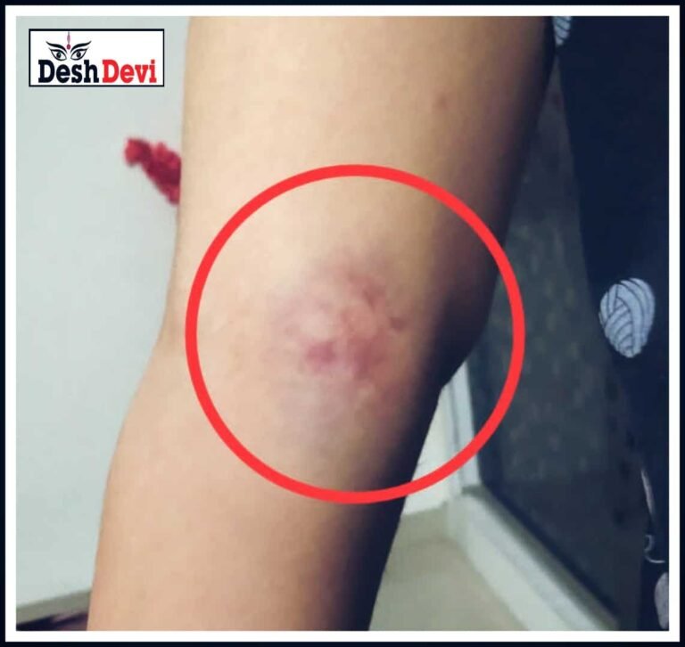 પટેલ કોલોનીમાં યુવતિ ઉપર આબરૂ લેવાના ઇરાદે  હુમલો કરતો કારચાલક