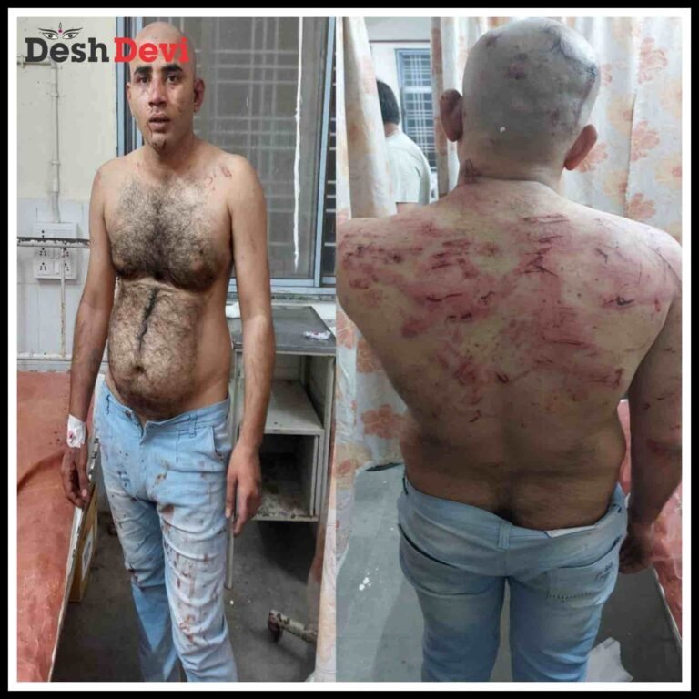 જામનગરમાં ‘मार’ का बदला ‘मार’ ઉદ્યોગનગરમાં ભાનુશાળી યુવાનને 5 શખ્સોએ ઢીબી નાખ્યો:જુવો Video