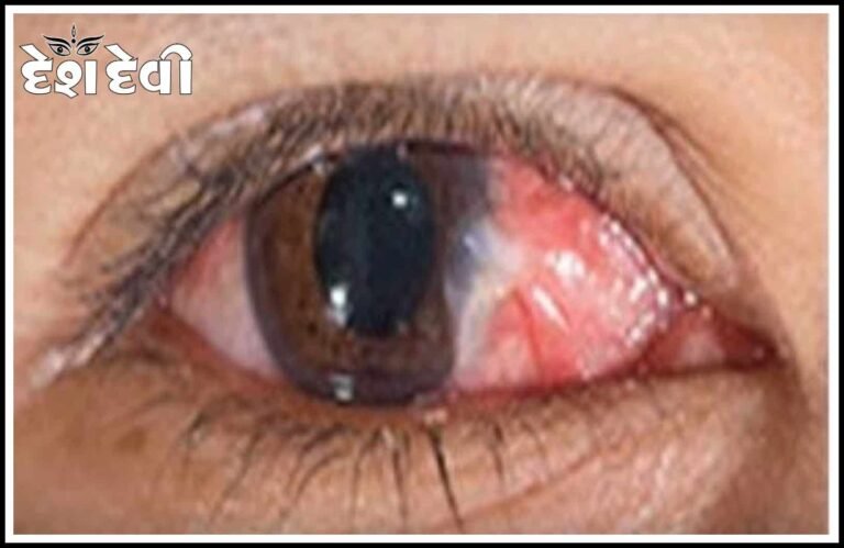 જામનગરના ગાંધીનગર વિસ્તારમાં યુવાનની આંખમાં સ્પ્રે છાંટી બે શખ્સોનો ફિલ્મી ઢબે હુમલો