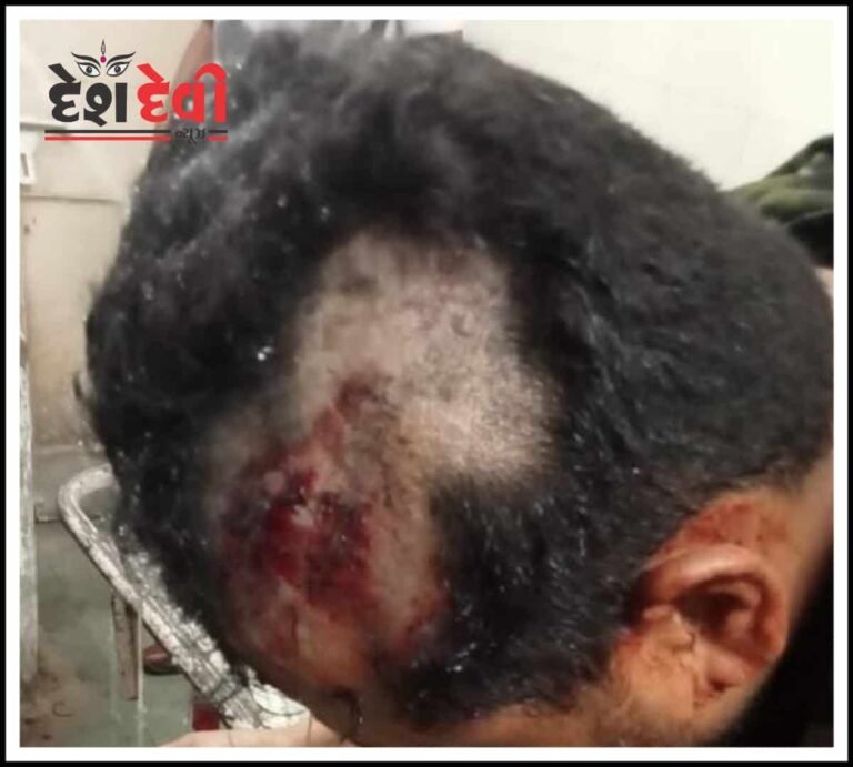 ઈન્દ્રપ્રસ્થમાં સીજીંગના કોન્ટ્રાક્ટ બાબતે ગઢવી યુવાન પર 4 શખ્સો ધોકા-છરી વડે ટૂટી પડ્યા