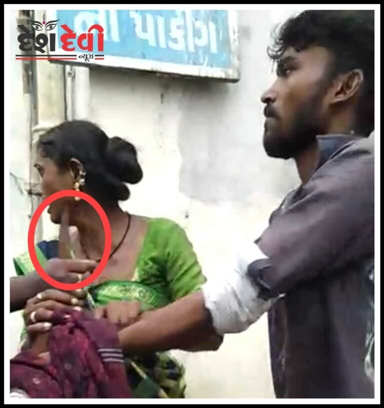 જામનગરની જી.જી હોસ્પિટલમાં જાહેરમાં છરીઓ ખેંચાણી જુવો video