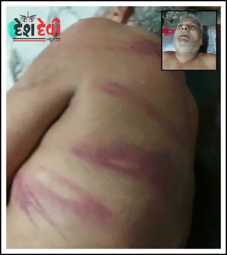 જામનગરમાં કેશ પાછો ખેંચવાનું કહી લોહાણા વૃદ્ધને 4 શખ્સોએ ધોકા ફટકાર્યાં