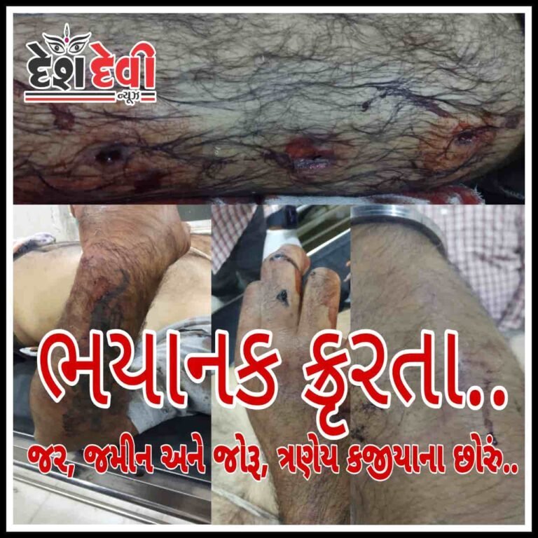 જામનગરમાં “મામા-મામી” નો ”ભાણેજ” ઉપર ખૂની હુમલો : 6 સામે ફરીયાદ: બ્રહ્મ સમાજમાં અરેરાટી