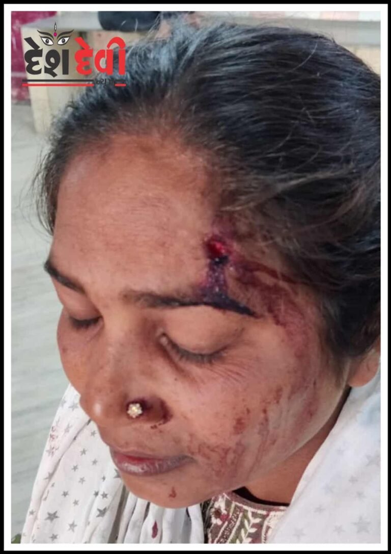 જામનગરમાં બ્યુટી પાર્લર સંચાલિકા પર મહિલા સહિત 4 શખ્સો ટુટી પડ્યા