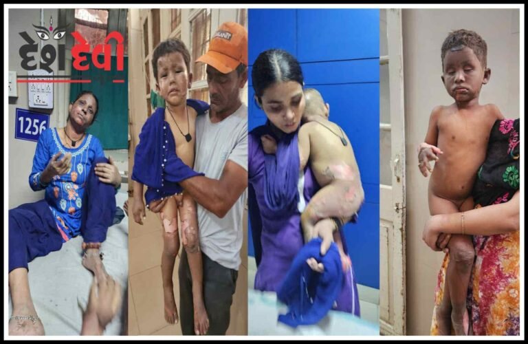 જામનગર દરેડમાં ગેસ લીકેજથી લાગેલી આગમાં દાઝી ગયેલા તરૂણનું હોસ્પિટલમાં મોત 