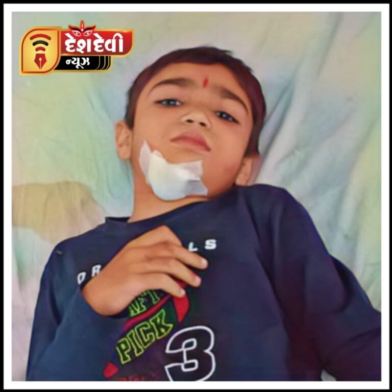 જામનગરમાં ઇન્દિરા કોલોની વિસ્તારમાં રસ્તે રઝળતા પશુના કારણે છ વર્ષનો બાળક ઘાયલ થયો