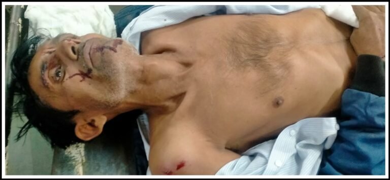 જામનગર વસઈ નજીક ભયાનક અકસ્માતથી હોસ્પિટલમાં ચિચિયારી ગુંજી : જુવો ફોટા