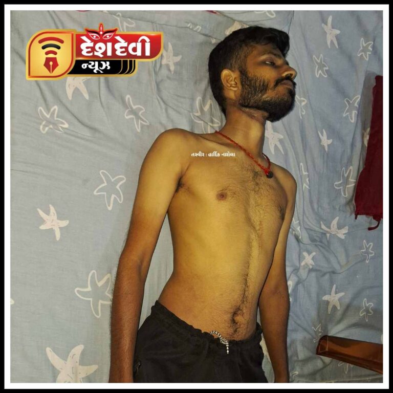જામનગરમાં દરજી યુવાનનો રહસ્યમય સંજોગોમાં આપઘાત